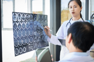 Aphasia brain scans