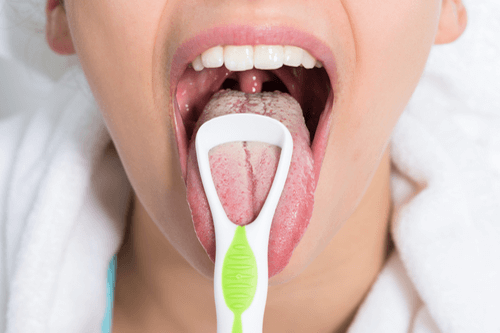 tongue fungus treatment