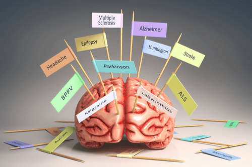 Huntington disease brain