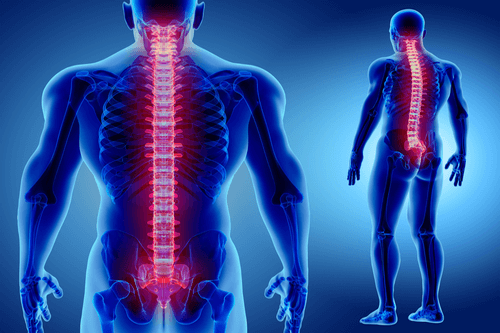 Transverse Myelitis_spine