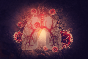 Cystic_fibrosis lungs