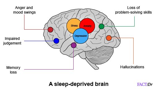 sleep deprived brain