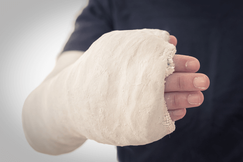 Bone fracture plaster