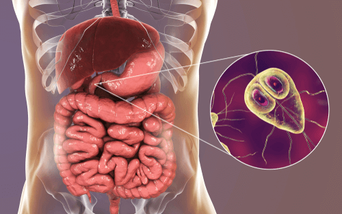 Giardia liver disease