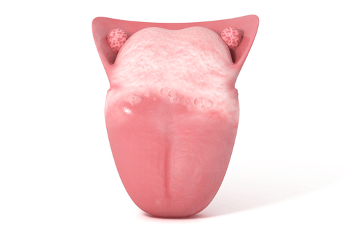 Leukoplakia tongue model