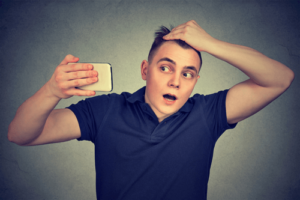 Male Pattern baldness causes