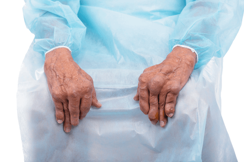 SEPTIC ARTHRITIS hands