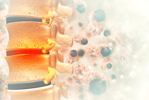 Spinal cord tumours