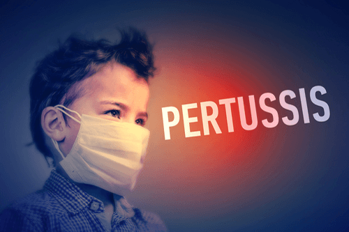 Whooping cough pertussis