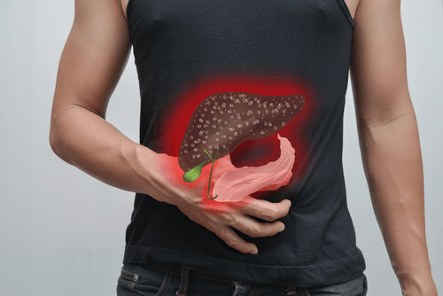 acute cholecystitis liver