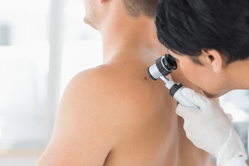 ACTINIC KERATOSIS and cancer