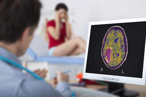 BRAIN CANCER diagnosis