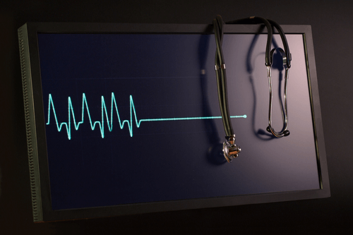 Congestive Heart Failure ekg