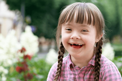 Down syndrome child