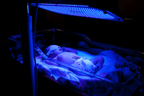 Neonatal jaundice treatment