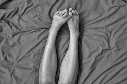 RESTLESS LEGS SYNDROME