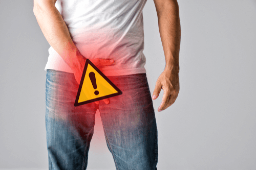 Jock Itch : Facts, causes, symptoms, treatment, & prevention - FactDr