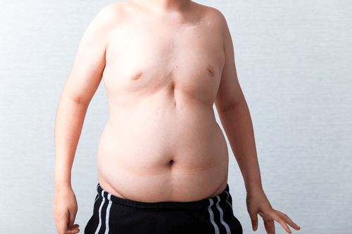 Metabolic disorders weight gain