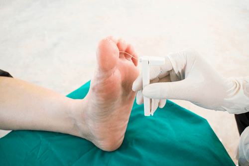 NEUROPATHY diabetic foot