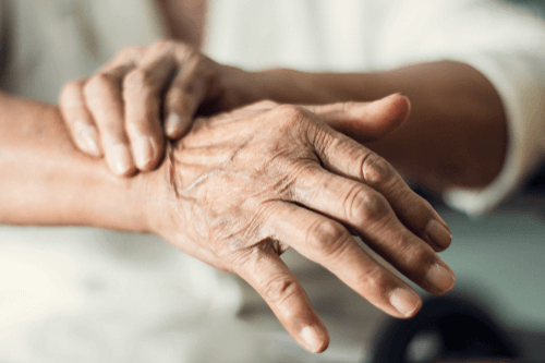 Parkinson’s disease hands