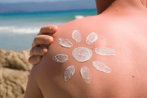 Summer skin hazards sunburn