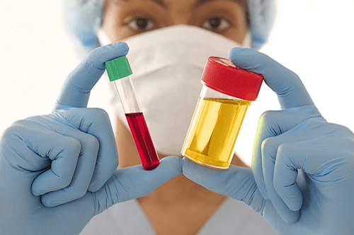Urinary Tract Infections test