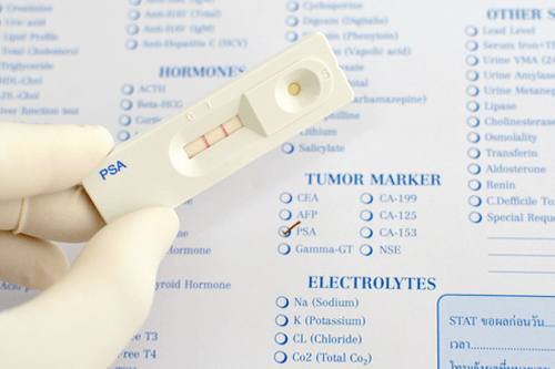 PROSTATE-SPECIFIC-ANTIGEN