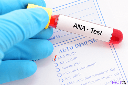 antinuclear antibody test