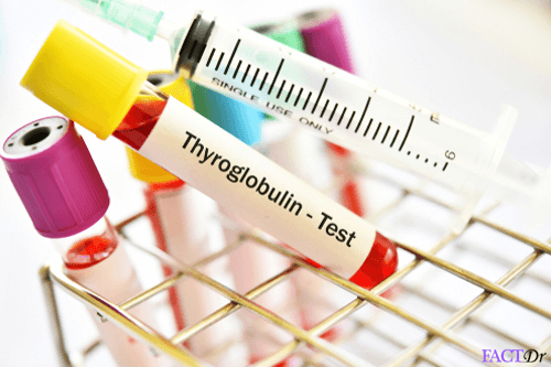 anti-thyroglobulin antibody