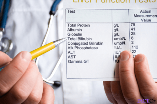 Bilirubin Levels Chart Adults