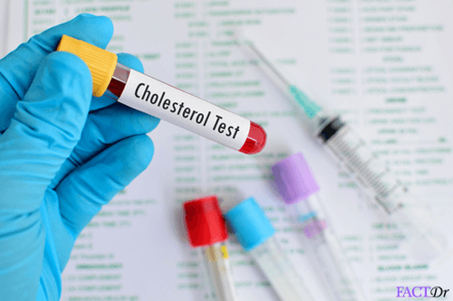 total-cholesterol-test