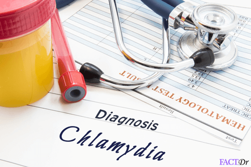 anti-chlamydia antibody tets