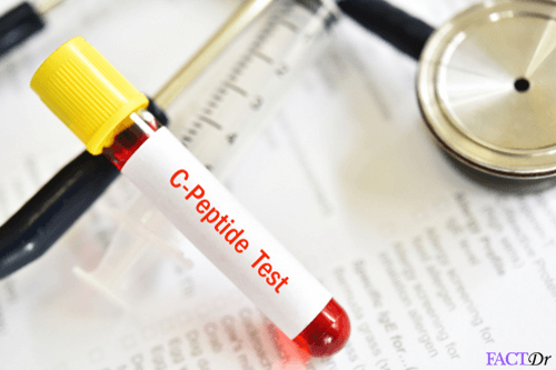 c peptide test