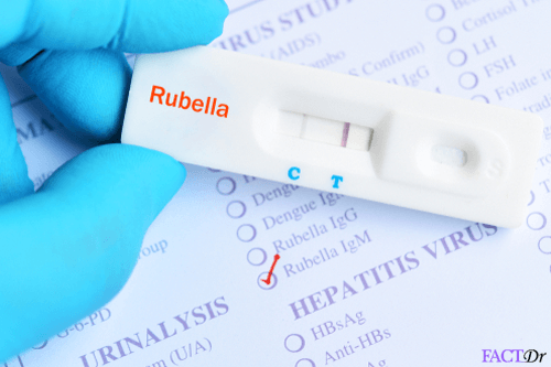 Rubella IgM test