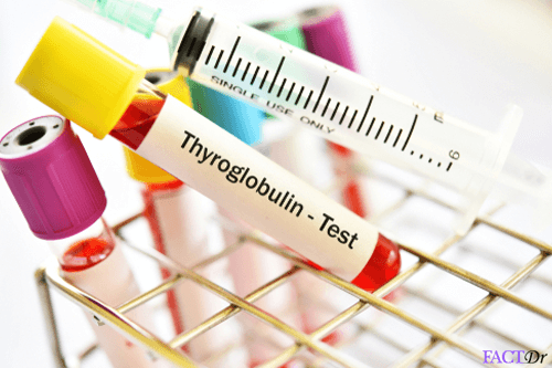 thyroglobulin test