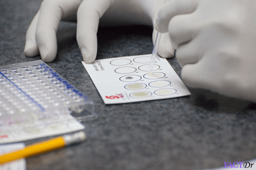 vdrl test syphilis