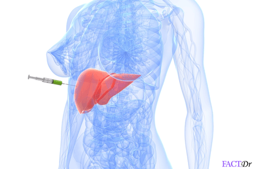 liver biopsy procedure