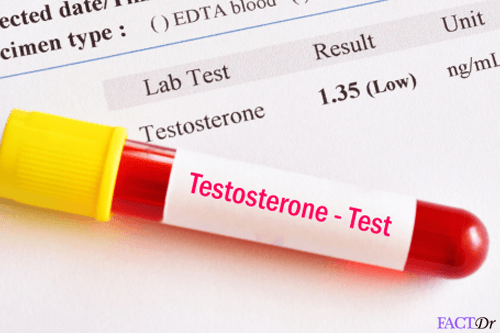 free testosterone test