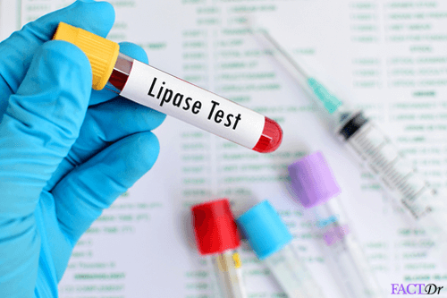 lipase test